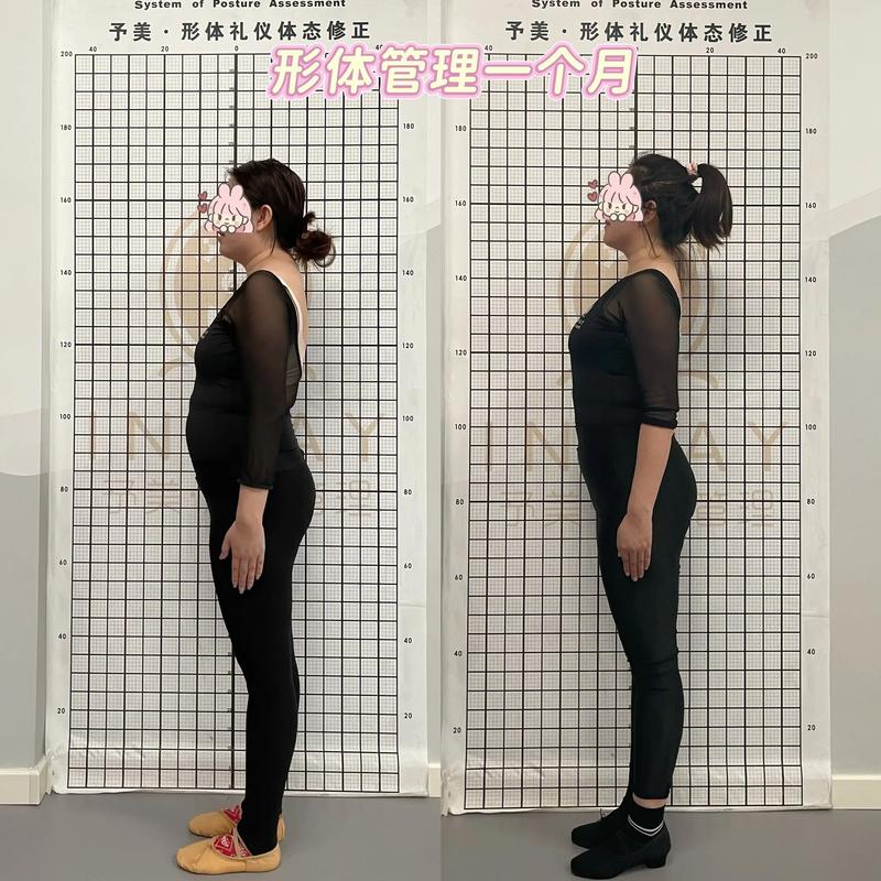 体态矫正